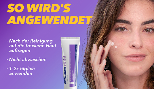 BENZAKNEN 5% gél, 15 ml
