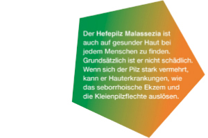 KETOZOLIN 2% šampón, 60 ml