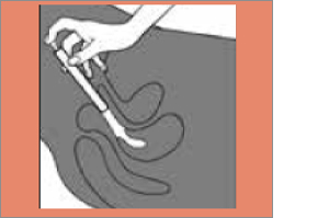 CLOTRIMAZOL AL 2% vaginálny krém, 20 g