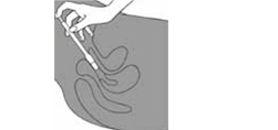 CLOTRIMAZOL AL 200 vaginálnych tabliet, 3 ks