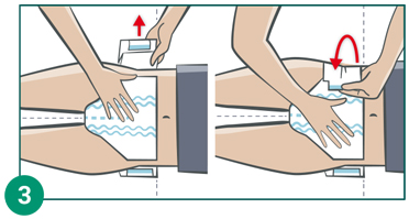 MOLICARE Premium Elastic Slip 9 kvapiek veľkosť M, 26 ks
