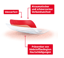 LEUKOMED T plus skin sensitive sterilný 8x10 cm, 5 ks