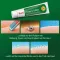 Ilon Protect masť (200 ml)