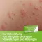 Cetirizin axicur® 10 mg filmom obalené tablety, 50 ks