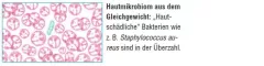 Instructions for use for AKTIVADERM ND Aktívne probiotiká na ošetrenie pokožky pri neurodermatitíde, 125 g - 2